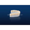 Customized Dental Zirconia Ceramic Teeth